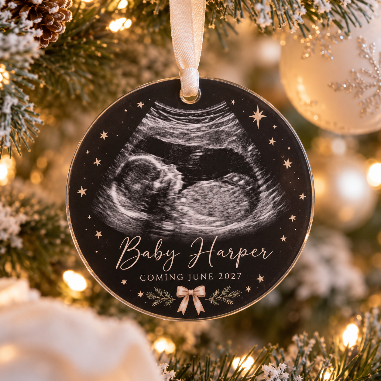Personalized Ultrasound Baby Announcement Ornament — Photo 5
